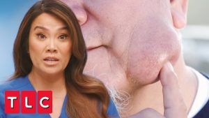 Like a Water Balloon Filled With Oatmeal” | Dr. Pimple Popper Like a Water Balloon Filled With Oatmeal” | Dr. Pimple Popper